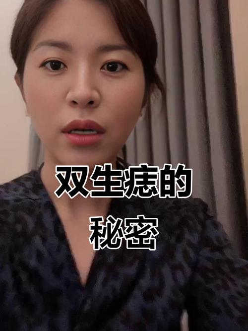 雙生痣是好還是壞 女孩子雙生痣的好處