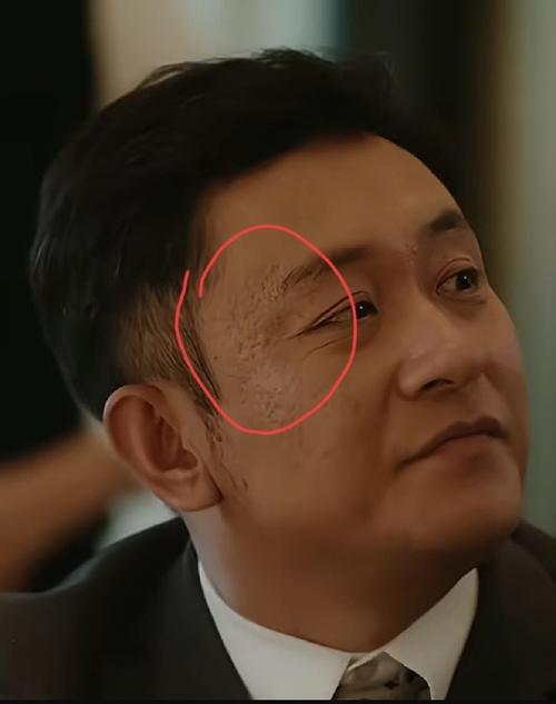 面相奸門凹陷的男人婚姻