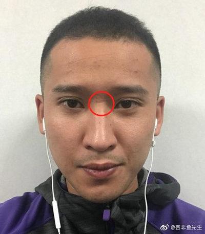 山根折斷的男人命運 命不好嗎