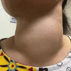 女人脖子粗有沒有福氣