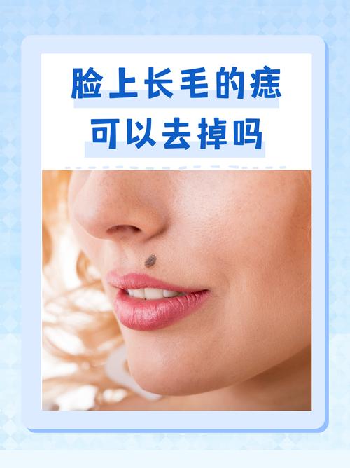 痣上長毛好不好象征著什么 眉毛痣長毛則善于理財