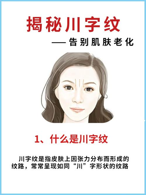 川字紋是怎么回事 身體安康事業穩步求勝