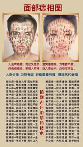 嘴角下面的痣可以點嗎 左右嘴角意義不同