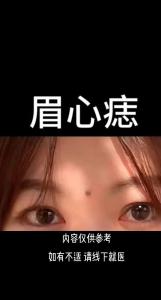 后天形成的觀音痣好不好 有黑色觀音痣的女人的命