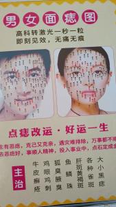 人中痣可以去掉嗎 貴人運旺盛事業成功優秀