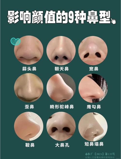 面相丑鼻子有幾種