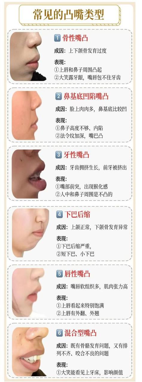 相學中嘴歪是無福之相嗎