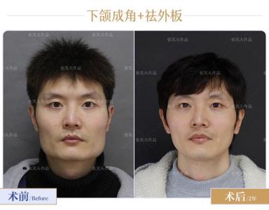 下巴方的男人面相分析 方下巴的男人好嗎