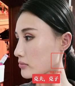 女人腮骨突出克夫嗎