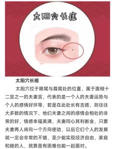 太陽穴長痣有什么含義？