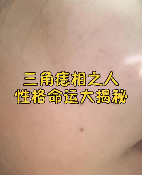 三角痣是命痣嗎 三顆痣成三角形的人命運