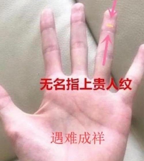 大拇指上有這種紋的人，男娶富妻女嫁貴夫