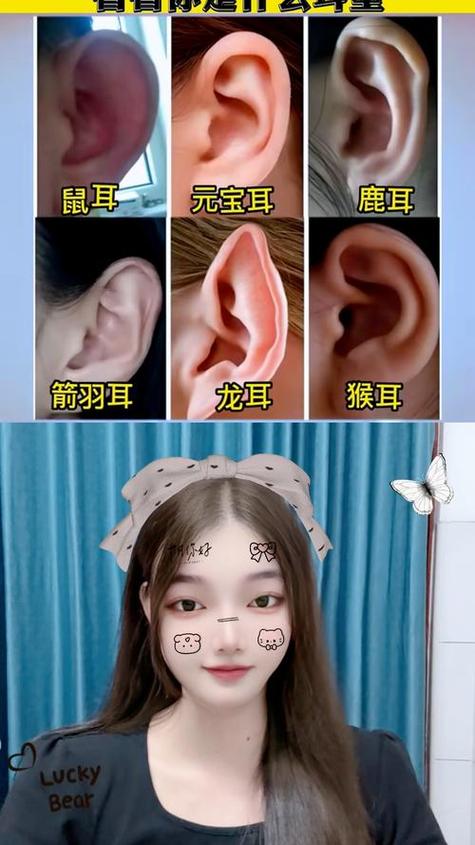 元寶耳朵什么樣 是好是壞