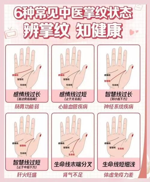 從掌紋看健康