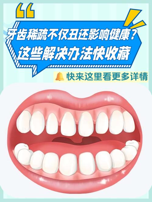 牙齒稀疏的人是不是沒福氣 運氣不好嗎