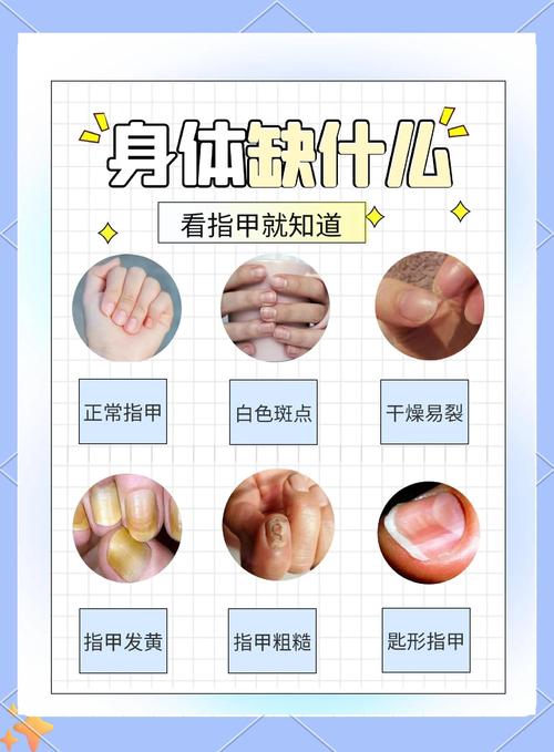 指甲告訴你的身體信號(hào)