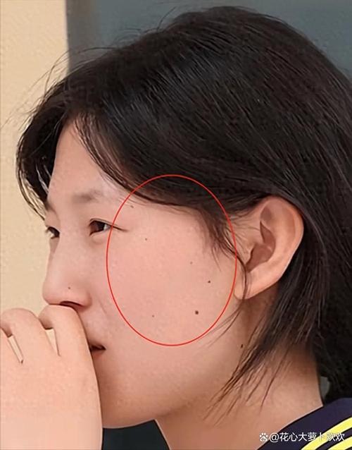 面帶北斗七星痣命運好不好 北斗七星痣的女人
