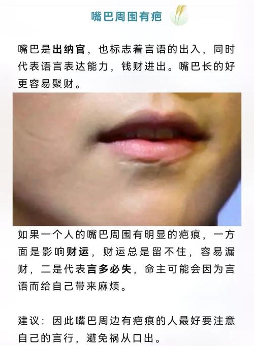面相學：容易招來霉運的疤痕