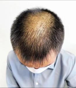 頭發稀少的人命運好嗎