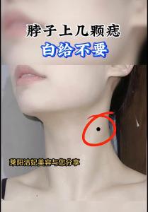 女人脖子上長(zhǎng)痣好不好