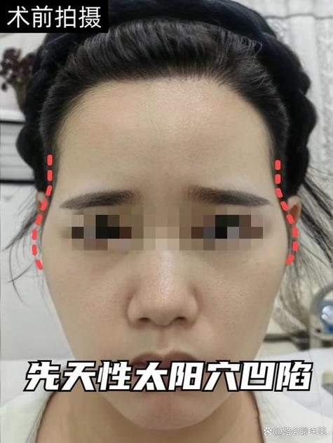 太陽(yáng)凹陷突然長(zhǎng)回來 事業(yè)有望需要把握時(shí)機(jī)