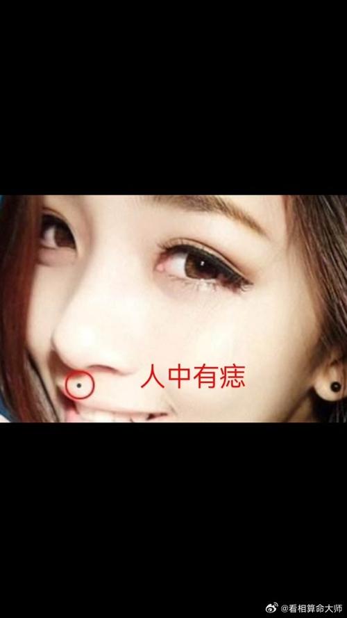 女人桃花痣在什么地方 女人印堂有痣為桃花痣