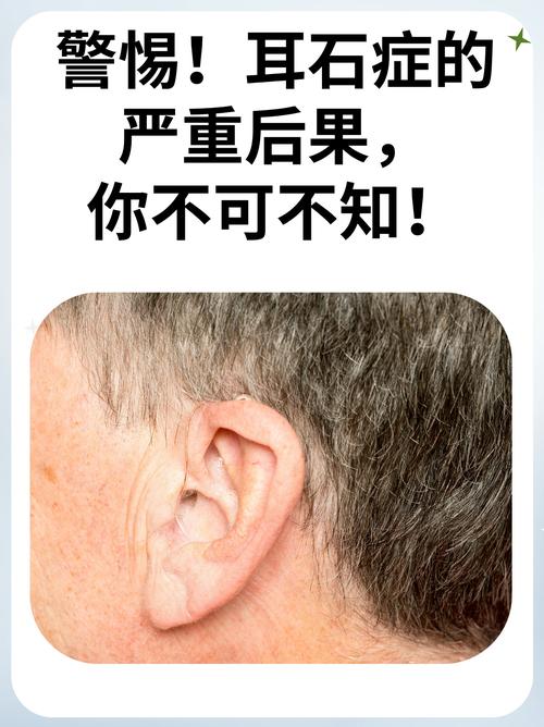耳朵天生缺一小塊是為啥? 這一類人的命不好嗎