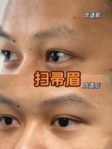 掃帚眉有化解的方法嗎 掃把眉怎么改運