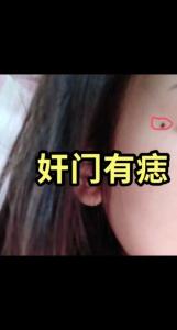 離婚痣長在哪里 左奸門處有痣肯能會有婚變