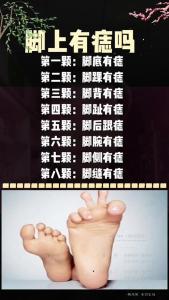 右腳踝長痣富貴圖解 右腳踝有痣代表什么含義