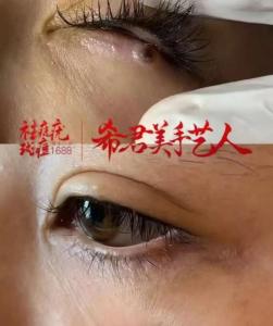 桃花痣和淚痣的區(qū)別 了解淚痣的浪漫傳說