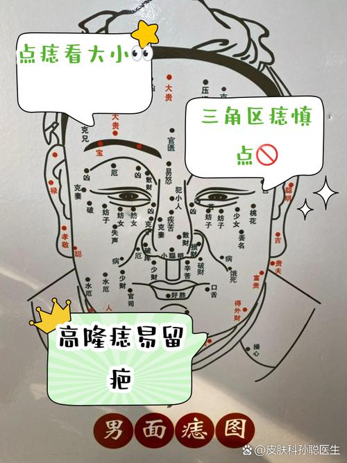 臉上的黑痣那些不能去掉嗎