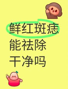 臉上紅痣能可以隨便去掉嗎