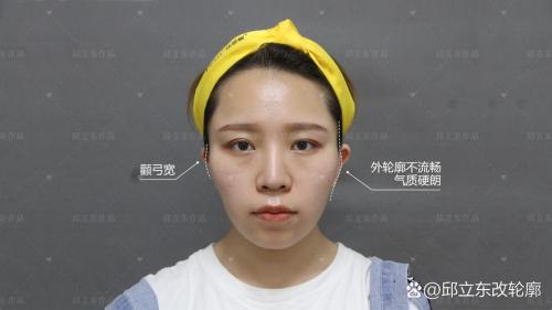 頜頸骨斜出者，刻薄無情是真的嗎