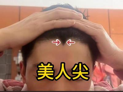 為什么說有美人尖的人有要害病