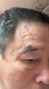 男人額頭上沒(méi)有抬頭紋運(yùn)勢(shì)好么