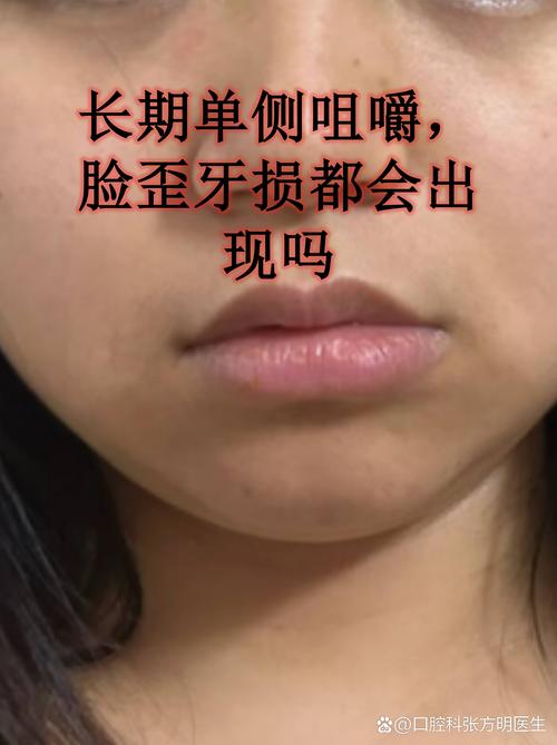 齙牙的女人面相 導致腸胃功能紊亂