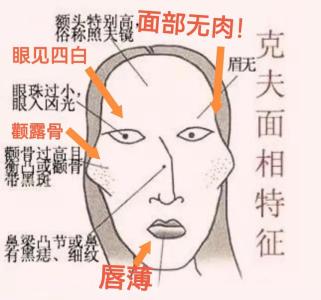 女人面相分析：易成為寡婦的面相