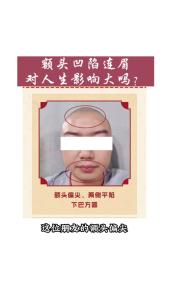 額頭平的女人命好不好 額頭面相怎么看