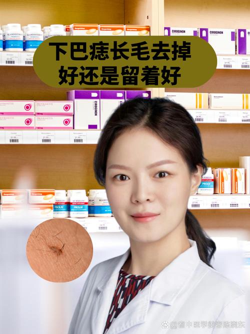 女生下巴痣上長毛是福還是禍