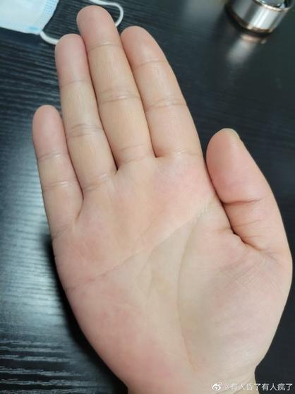 沒有感情線的手相好不好