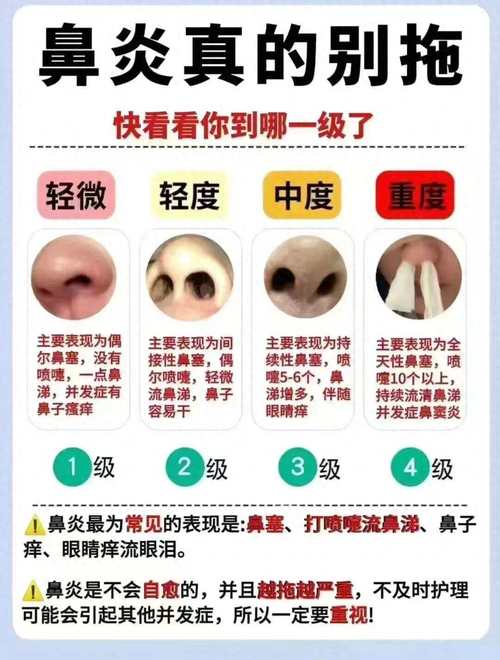 鼻子看你一生的成與敗