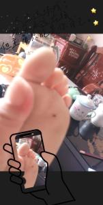 小孩腳底有痣好不好