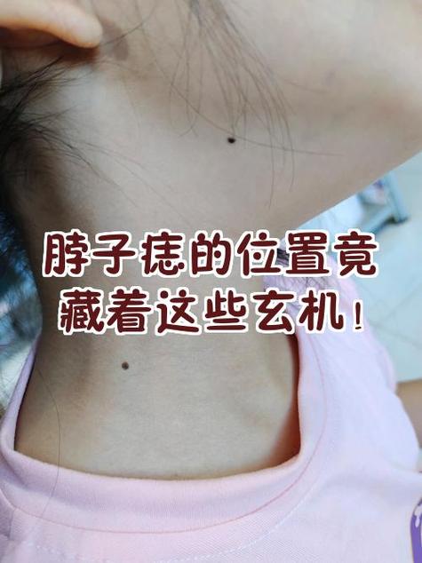 仙女下凡投胎痣的位置在哪里