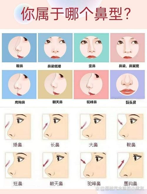 福氣鼻是怎樣的 有哪些