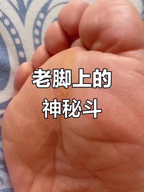 腳掌有斗的人好命 腳底踩斗是怎么個說法