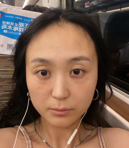 女人窮相特征眼球深陷 是好命嗎