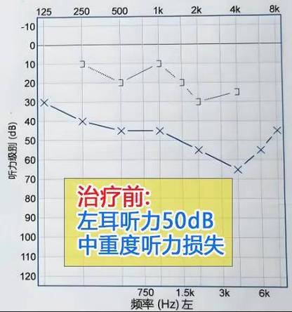 申時左耳鳴是什么預兆