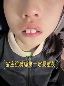 睡覺嘴巴張開面相