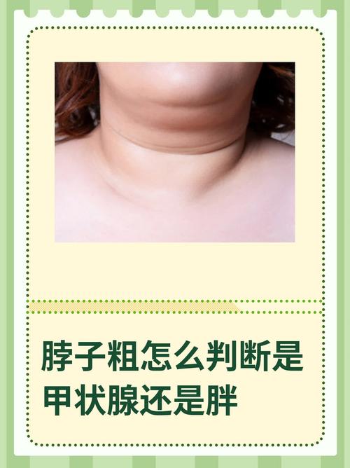 脖子很粗的女人運勢如何